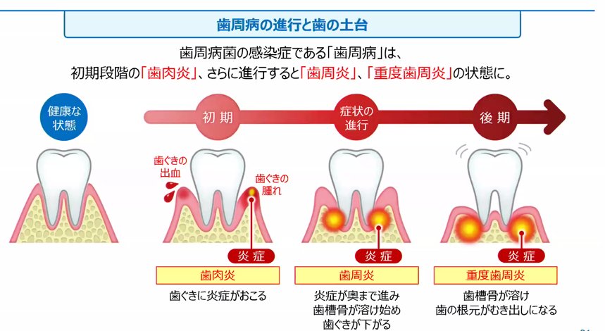 お役立ち情報 さいたま市岩槻区 審美歯科のスワンデンタルクリニック